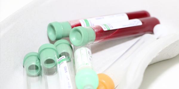 Blutproben eines Patienten mit Hypercholesterinämie stehen für Laboranalysen bereit.