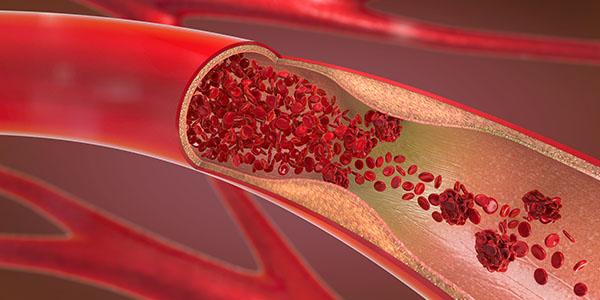 Anmiationsbild eines aufgeschnittenen Blutgefäßes mit roten Blutkörperchen